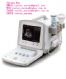 portable ultrasound scanner - ce certified (cms 600b-2)